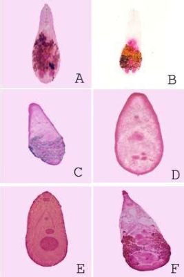  Heterophyes Heterophyes: A Tiny Trematode That'll Make You Think Twice About Sushi!