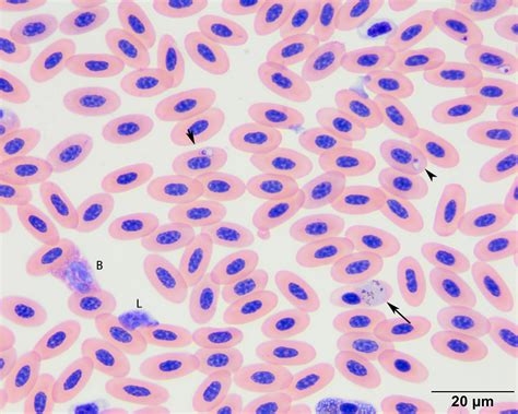 Hematocystis! A Blood-Dwelling Parasite That Thrives In Avian Red Blood Cells!