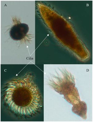  Strombidium! A Tiny Ciliate That Swims with Style and Eats Like a Vacuum Cleaner